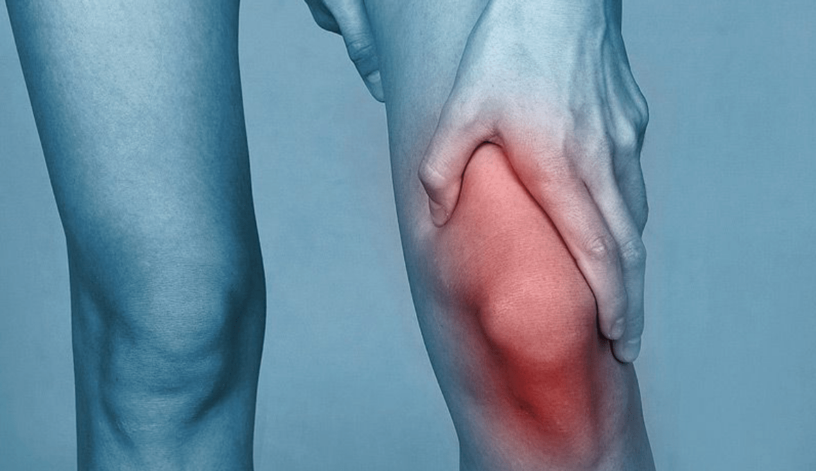 Douleur dans l'articulation du genou due à l'arthrose