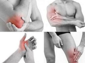 Douleur dans les articulations des bras et des jambes
